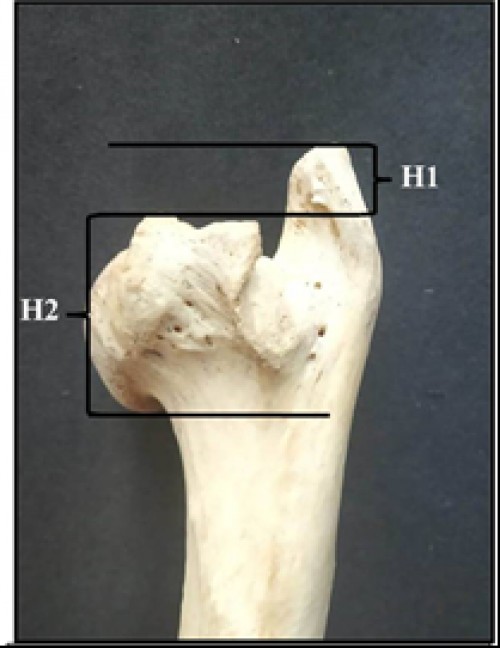 Photograph showing lengths of different segments of humerus of Indian Barking deer (contd.)