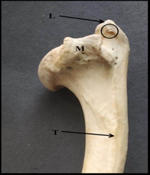 Photograph showing medial surface of humerus of Indian Barking deer showing teres tubercle (T), medial tuberosity (M), lateral tuberosity (L) and two spine-like structures on lateral tuberosity (encircled)