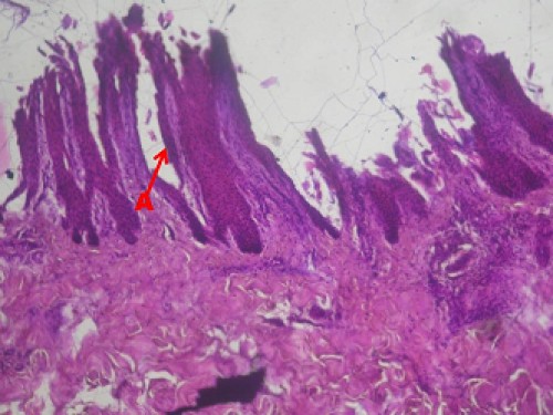 Photomicrograph showing the keratinized stratified squamus epithelium pedal gland of Greater one horn rhinoceros