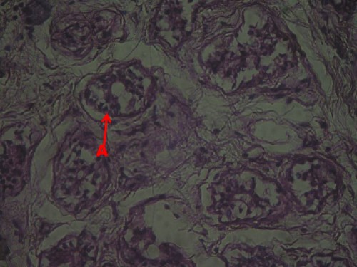 Photomicrograph showing the abundant acini (arrow) in the distal part of the gland of Greater one horn Rhinoceros