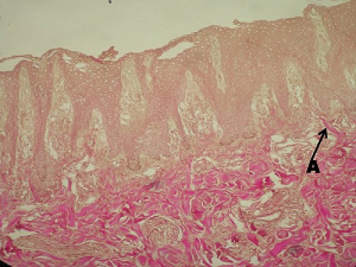 Photomicrograph showing the collagen fibers (arrow) of Pedal scant gland of Greater one horn Rhinoceros