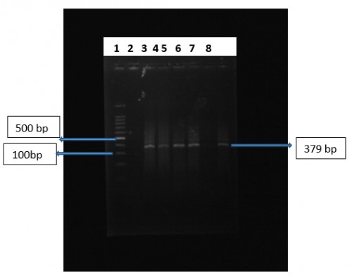 Detection of VP6 gene of bovine rotavirus by RT-PCR Lane 1: Molecular weight marker (100 bp ladder) Lane 2: Negative control Lane 3: Positive control Lane 4, 5, 6, 8: Positive samples Lane 7: Negative sample