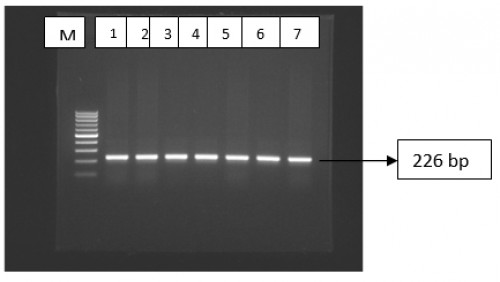 <em>Agarose gel electrophoresis of (</em>etb) of <em>S. aureus</em> as a genotyping identification of the isolates. Lane M: Marker encoding gene (marker (100 –1000 bp). Lanes 1-7: positive samples for (<em>etb</em>) gene with amplicon size of 226 bp