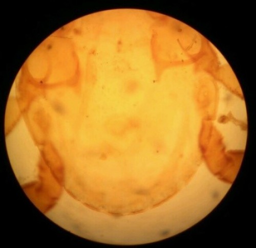Posterior End