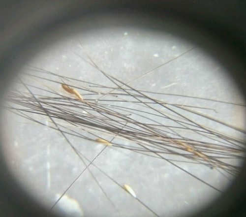 <em>Gasterophilus</em> spp. eggs attached to the body hair