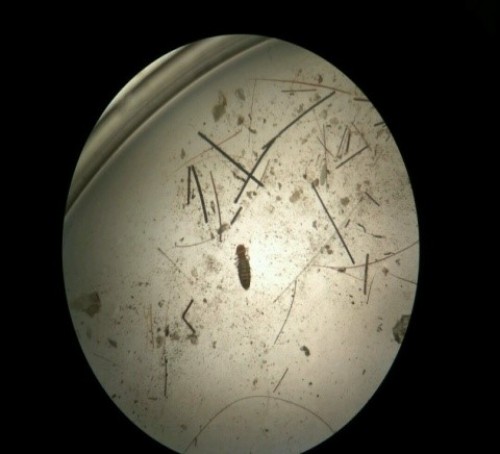 Adult <em>Damalinia</em> louse with egg cemented to the hair
