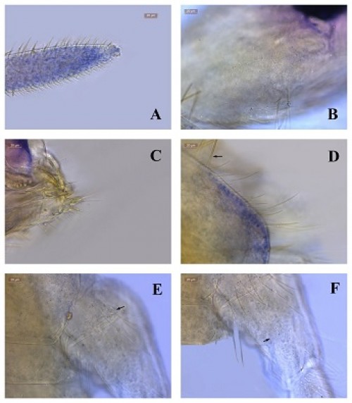 <em>Acanthurella satkosiaensis </em>n.sp.: 2A: Ant. IV without apical bulb; 2B: Cephalic scales &amp; setae; 2C: Mouthparts; 2D: Mc on collar; 2E: Mc on precoxae; 2F: Mc on coxae