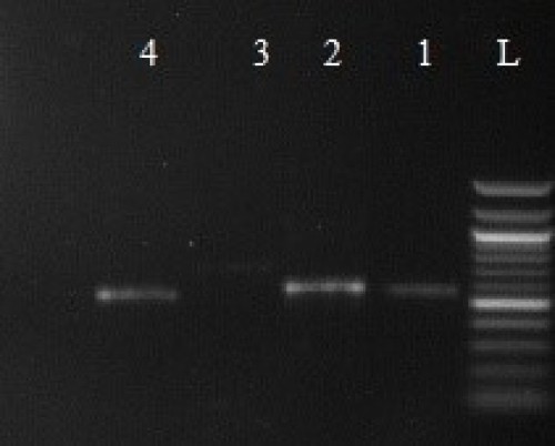 PCR analysis of fungal isolates using ITS primers
(L: 1kb plus marker, lane 1- S<sub>3</sub>C<sub>1</sub>, lane 2- S<sub>1</sub>C<sub>1</sub>,
and Lane 4- S<sub>5</sub>C<sub>1</sub>)