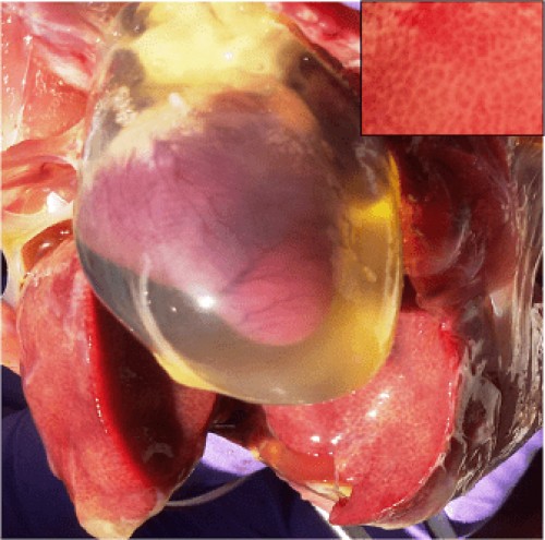 Hepatitis–hydropericardium syndrome in poultry: Enlarged, pale, friable liver with areas of congestion (inset; liver with contained numerous focal to coalescing pale necrotic areas) and pericardial sac containing clear straw colored fluid transudate (arrows)